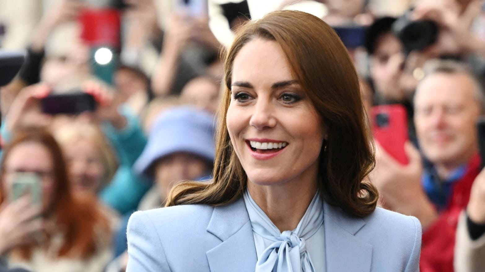 Kate Middleton es hospitalizada por cirugía abdominal