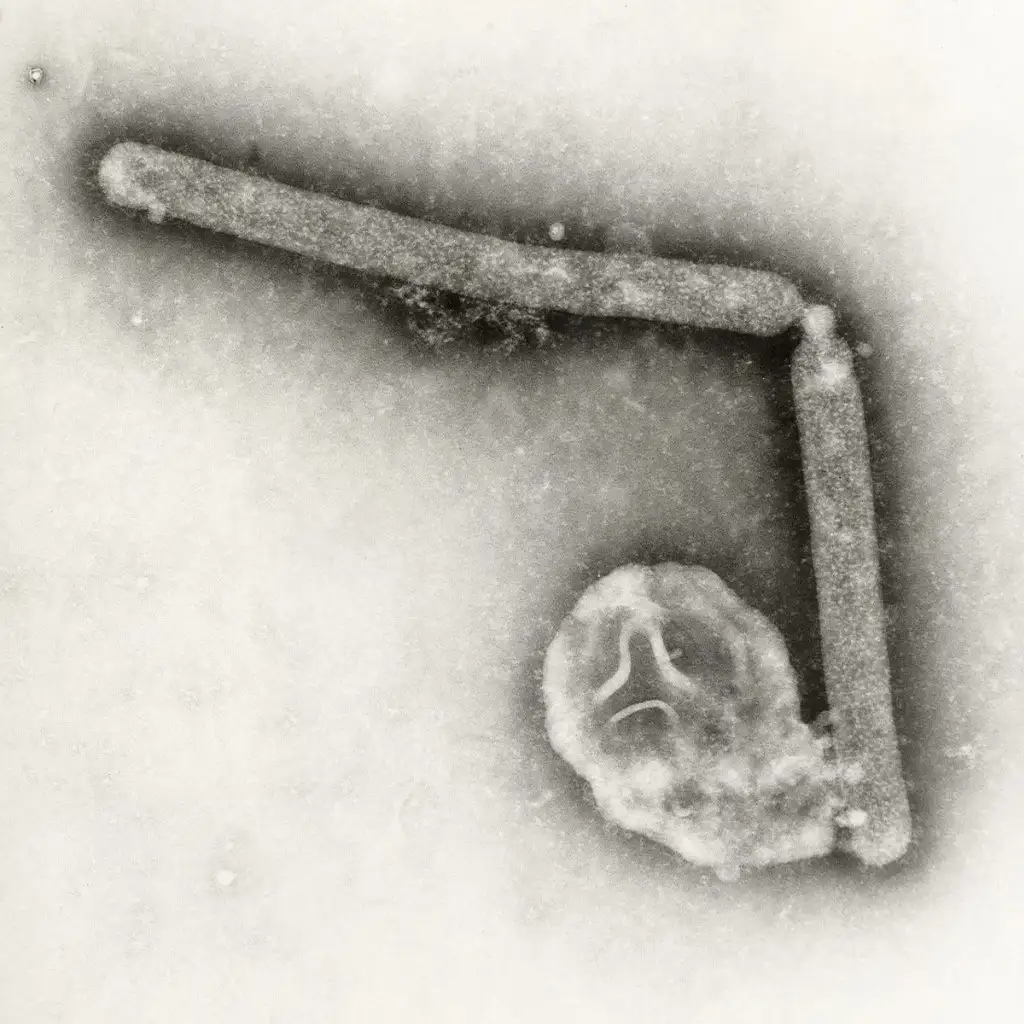 COBRA LA GRIPE AVIAR SU PRIMERA VÍCTIMA EN ESTADOS UNIDOS