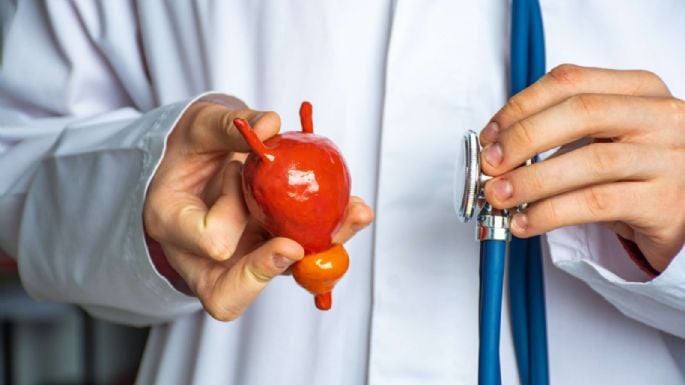 Es el tabaco principal factor de riesgo en cáncer de vejiga